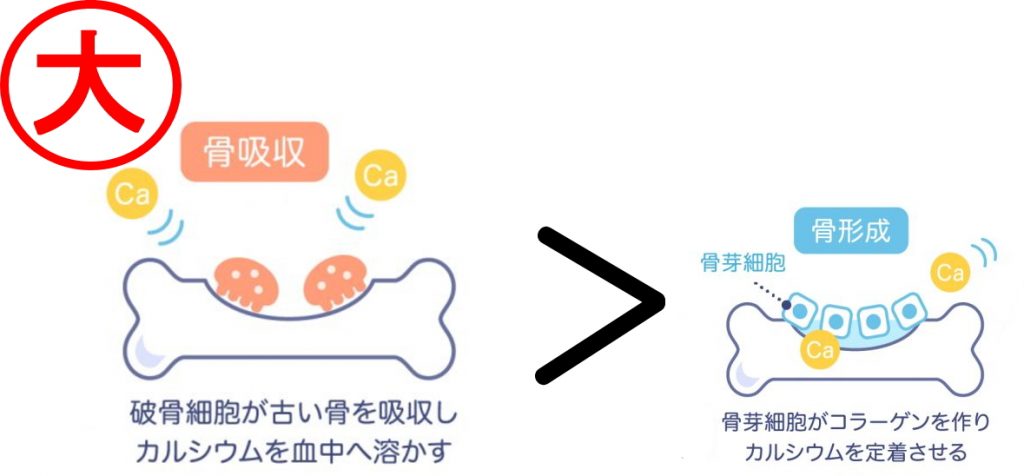 のぞみ整形外科クリニック西条　骨粗鬆症治療③